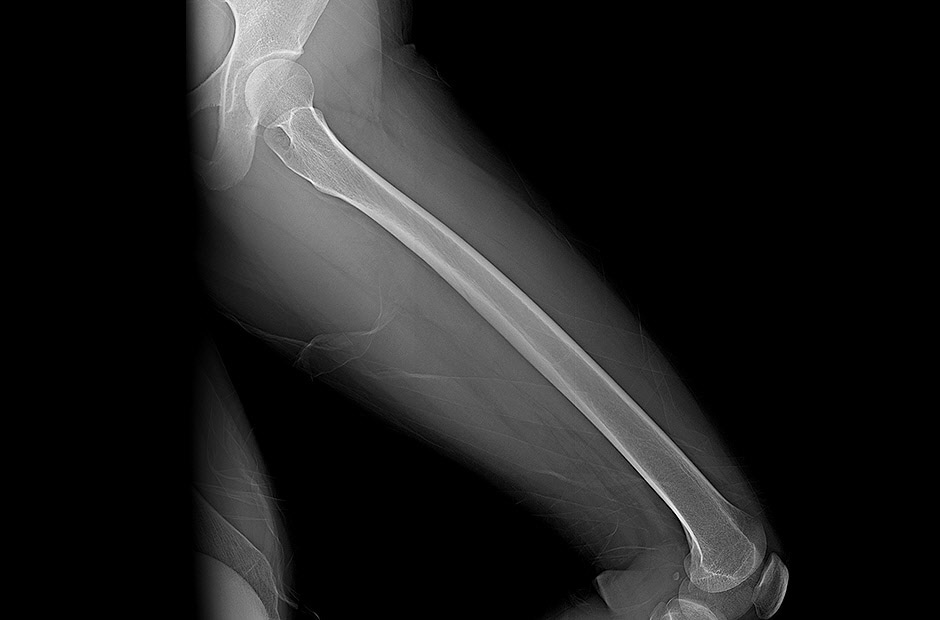 Medical-DXD-14HK701G-W-01-2-5-Exceptional_1556702838831_1579245842880