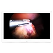 LG إل جي 27 بوصة UHD شاشة العمليات الجراحية 8MP من , 27HJ710S-W, thumbnail 3