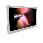 LG إل جي 27 بوصة UHD شاشة العمليات الجراحية 8MP من , 27HJ710S-W, thumbnail 4