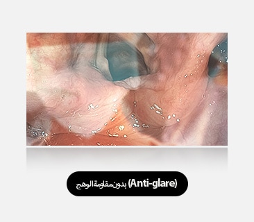 تُظهر الصورة اليسرى شاشة لا تحتوي على ميزة مقاومة الوهج (Anti-glare)، حيث تتسبب الانعكاسات والوهج في حجب الرؤية.
