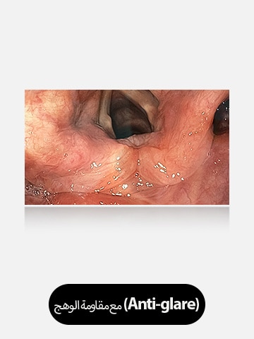 الصورة الموجودة على اليمين، المزودة بالطلاء المضاد للوهج، توفر رؤية واضحة وخالية من العوائق، مما يوضح فعالية الطلاء.