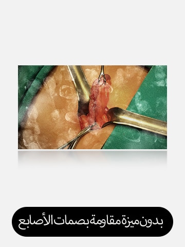 تعرض الصورة اليسرى شاشة مع بصمات أصابع ولطخات مرئية، مما يعيق الرؤية.