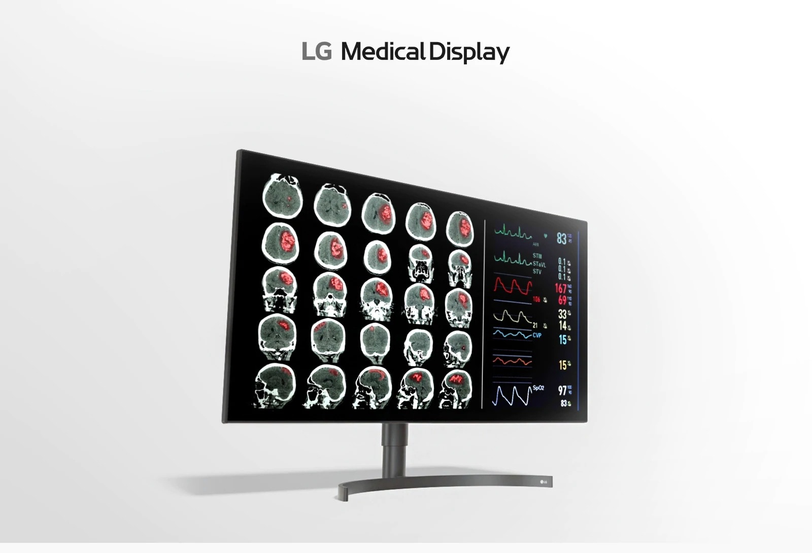 شاشة تشخيصية 8 ميجابكسل بحجم 31.5 بوصة3
