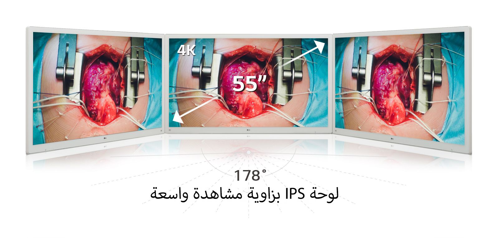 استمتع بصور نابضة بالحياة على شاشة العرض الجراحية بدقة 4K مقاس 55 بوصة من LG، المزودة بلوحة IPS التي توفر زاوية عرض واسعة تبلغ 178 درجة.