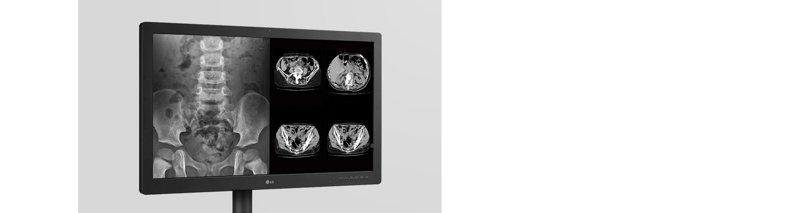 صورة موثوق فيها لحالات التقييم الدقيقة