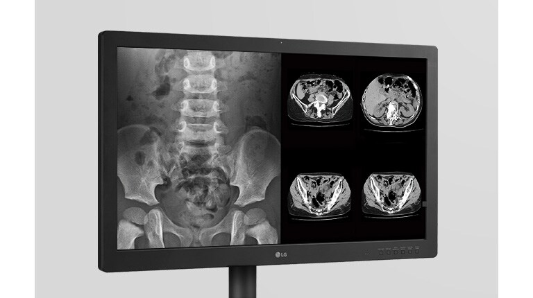 صورة موثوق فيها لحالات التقييم الدقيقة