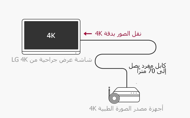دعم 12G-SDI: تتيح شاشة LG 4K الجراحية النقل لمسافات طويلة لإشارات 4K عبر كابل محوري واحد دون تأخير لإجراء جراحة مستقرة.