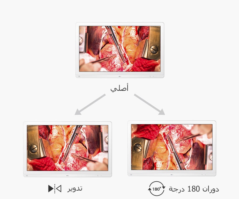 شاشة أصلية، شاشة تدوير، ودوران 180 درجة
