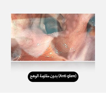 تُظهر الصورة اليسرى شاشة لا تحتوي على ميزة مقاومة الوهج (Anti-glare)، حيث تتسبب الانعكاسات والوهج في حجب الرؤية.