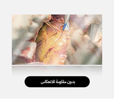 تُظهر الصورة اليسرى شاشة بدون انعكاس، مع مزيد من الوهج والانعكاسات التي تؤثر على الرؤية.