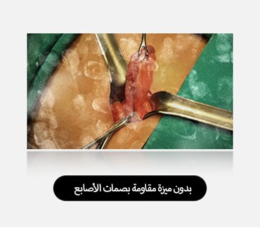 تعرض الصورة اليسرى شاشة مع بصمات أصابع ولطخات مرئية، مما يعيق الرؤية.