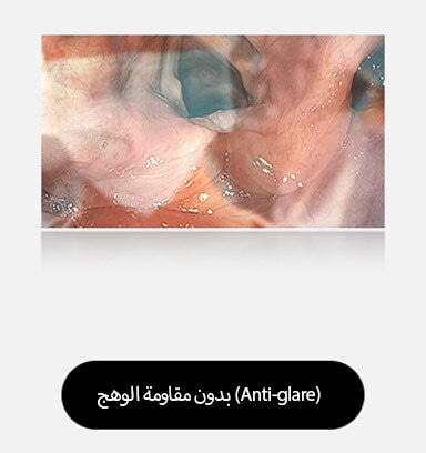 تُظهر الصورة اليسرى شاشة لا تحتوي على ميزة مقاومة الوهج (Anti-glare)، حيث تتسبب الانعكاسات والوهج في حجب الرؤية.