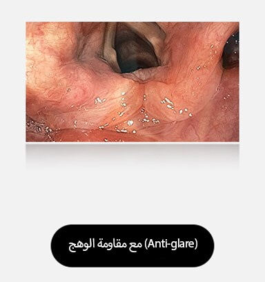 الصورة الموجودة على اليمين، المزودة بالطلاء المضاد للوهج، توفر رؤية واضحة وخالية من العوائق، مما يوضح فعالية الطلاء.