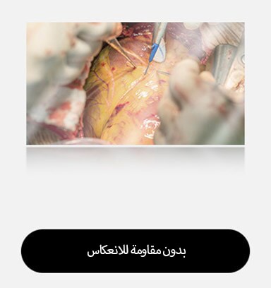 تُظهر الصورة اليسرى شاشة بدون انعكاس، مع مزيد من الوهج والانعكاسات التي تؤثر على الرؤية.