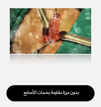 تعرض الصورة اليسرى شاشة مع بصمات أصابع ولطخات مرئية، مما يعيق الرؤية.