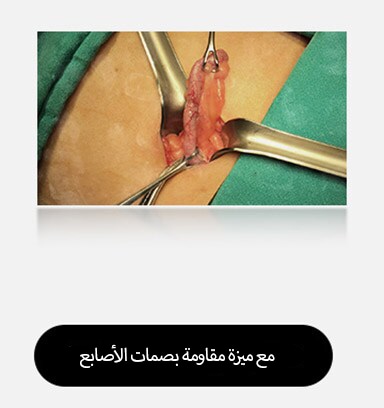 الصورة الموجودة على اليمين، مع الطلاء المضاد لبصمات الأصابع، تبدو واضحة، وبدون بقع، مما يوفر رؤية أفضل للمنطقة الجراحية.