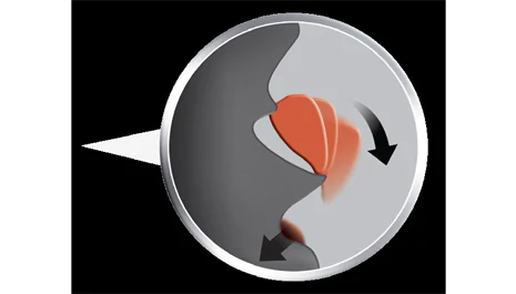 Le nettoyage catalytique