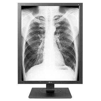 21” IPS Diagnostic Review Monitor1
