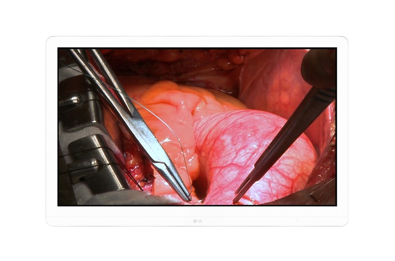 LG 27'' Ultra HD Surgical Monitor, 27HJ710S, thumbnail 1