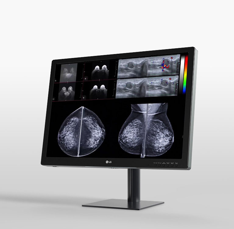 écran IPS de 31 pouces et de 12 mp de lg, conçu pour l’imagerie mammaire, offrant un flux de travail simplifié et un confort amélioré