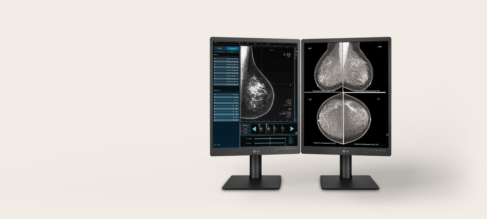 Moniteur IPS de Diagnostic de 21,3 po et 5 MP.