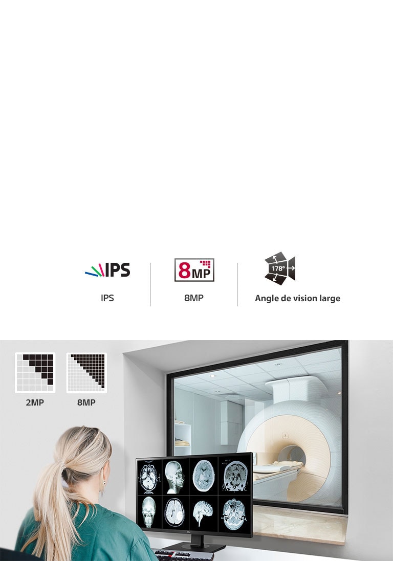 Qualité d’image supérieure