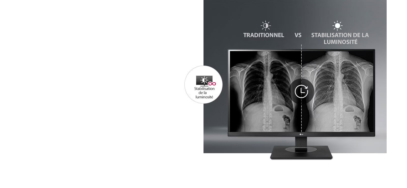 Un affichage stable et constant