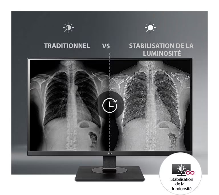 Un affichage stable et constant