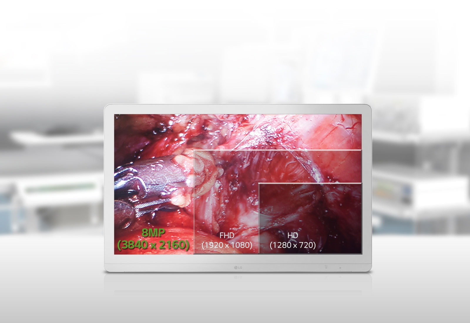 Écran UHD IPS 8 MP 27 Premium1