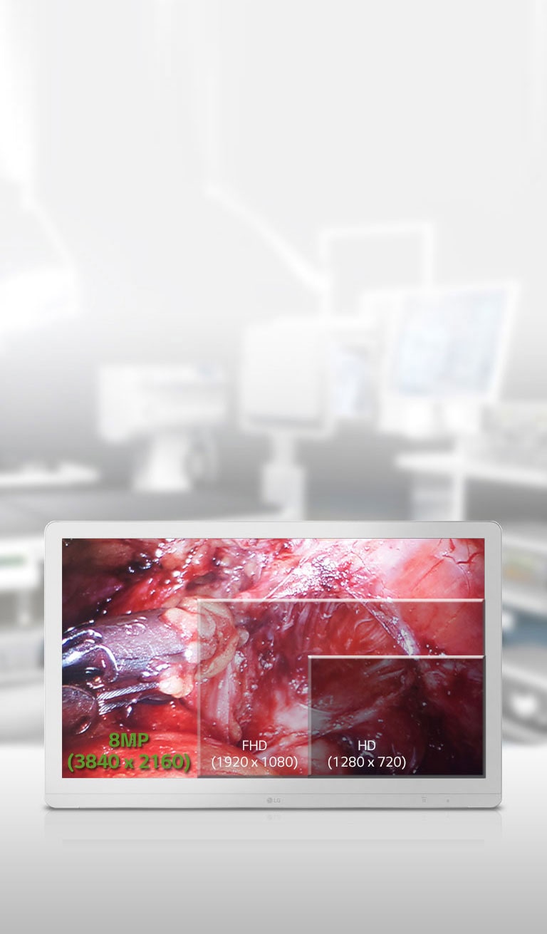 Écran UHD IPS 8 MP 27 Premium2