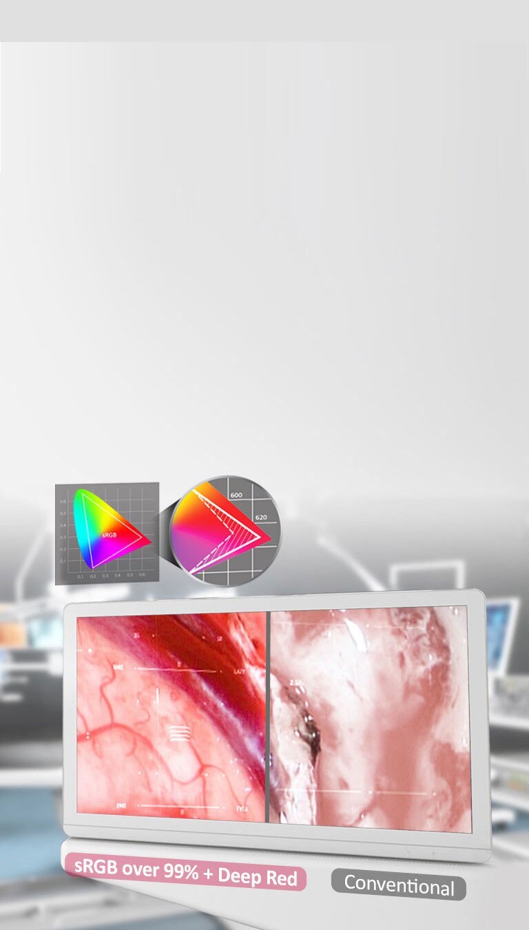 IPS & sRGB à plus de 99% + ROUGE profond2