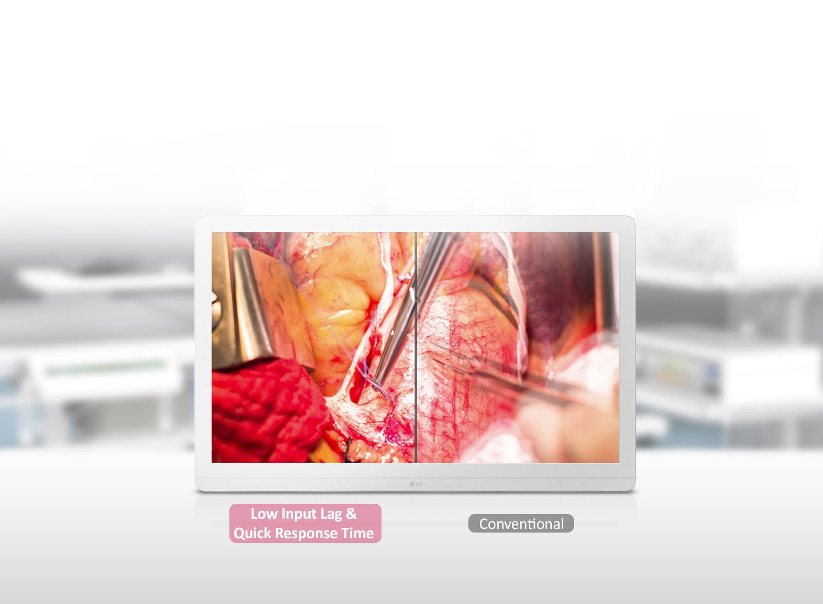 Mode Dynamic Sync et temps de réponse rapide1