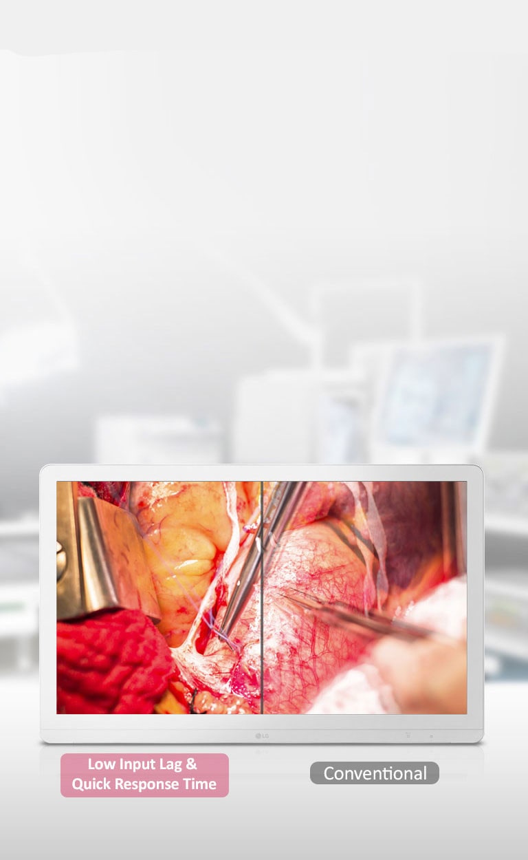 Mode Dynamic Sync et temps de réponse rapide2