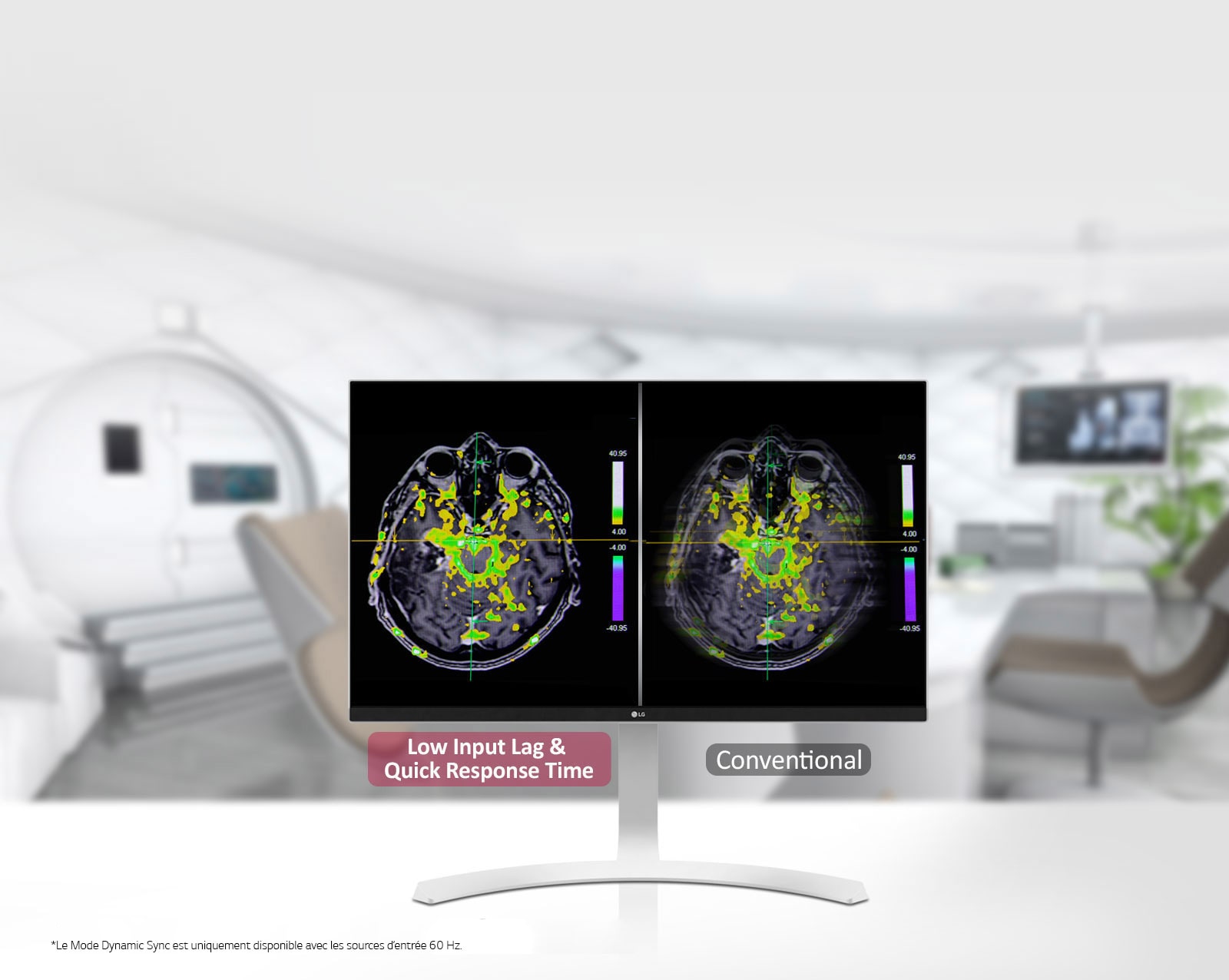 Mode Dynamic Sync et temps de réponse rapide 1