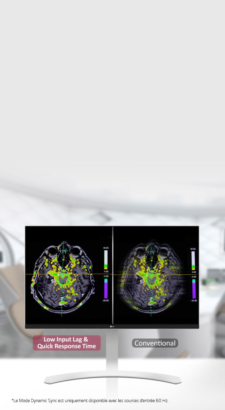 Mode Dynamic Sync et temps de réponse rapide 2
