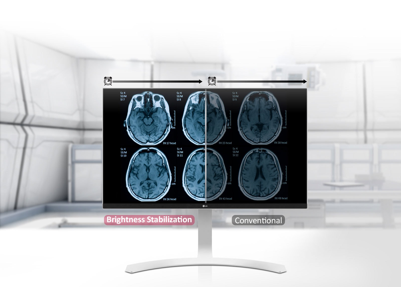 Stabilisation de la luminosité 1