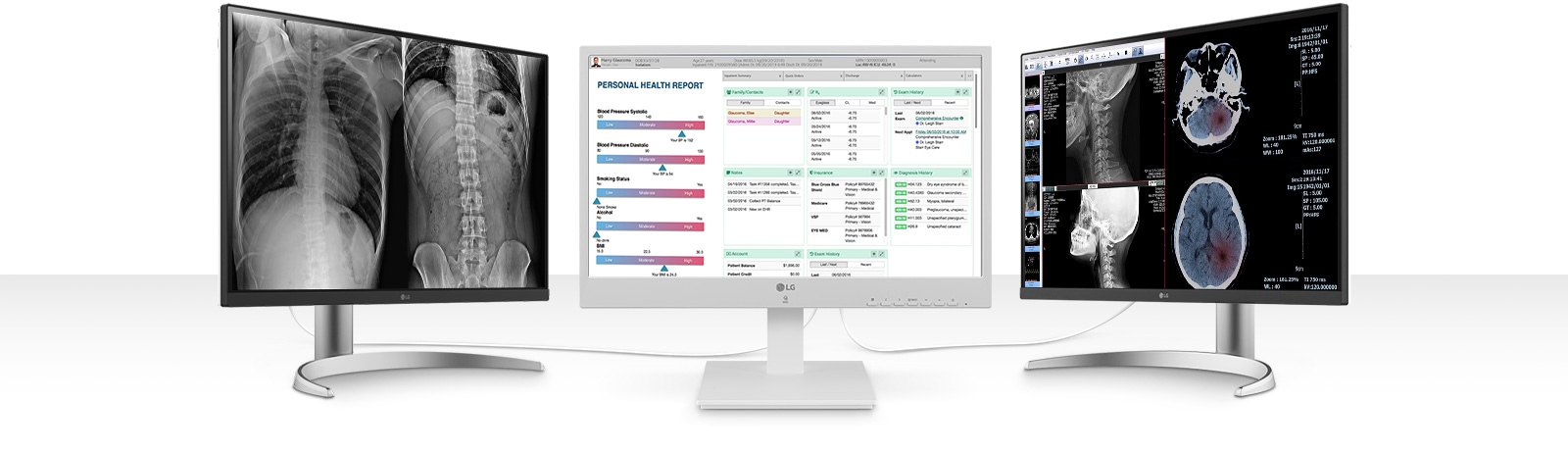 Le 24CR670N de LG prend en charge deux écrans avec une résolution allant jusqu’à 4K UHD. Grâce à la flexibilité des options de configuration multi-moniteurs, vous pouvez faire plus en moins de temps.