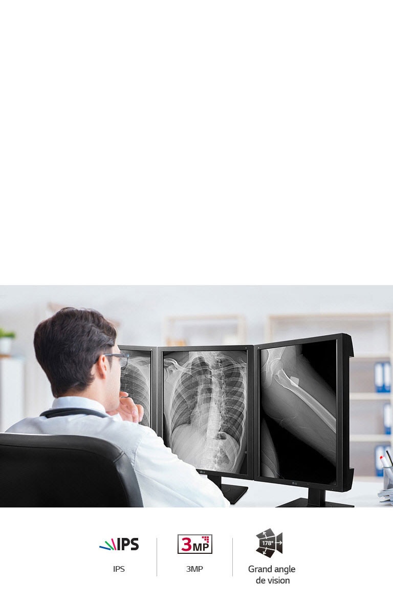 Qualité d'image précise2