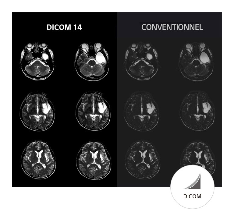 Images stables en niveaux de gris2