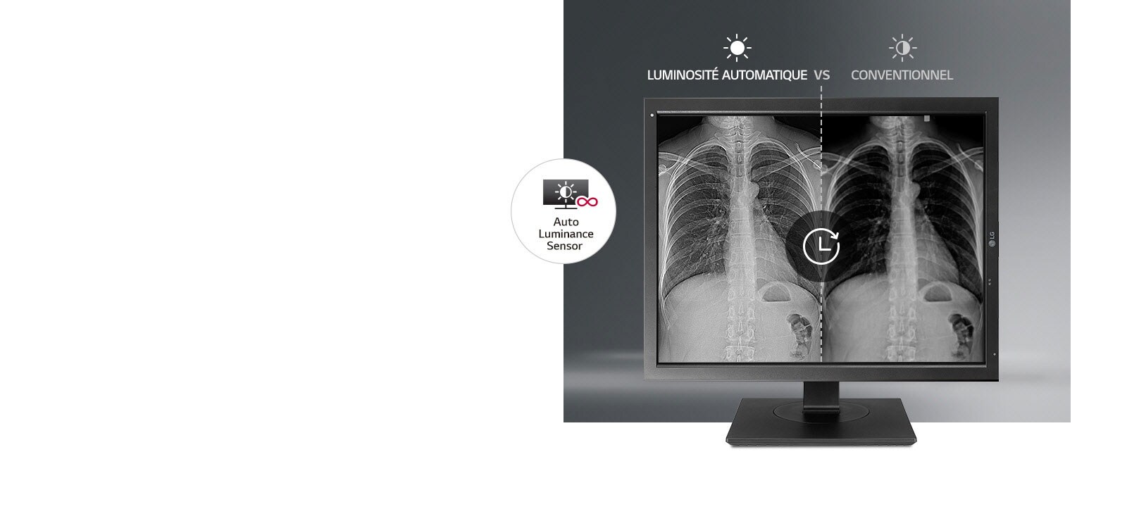 Stabilisation automatique de la luminosité1