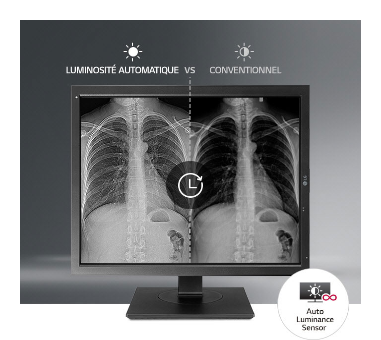 Stabilisation automatique de la luminosité2