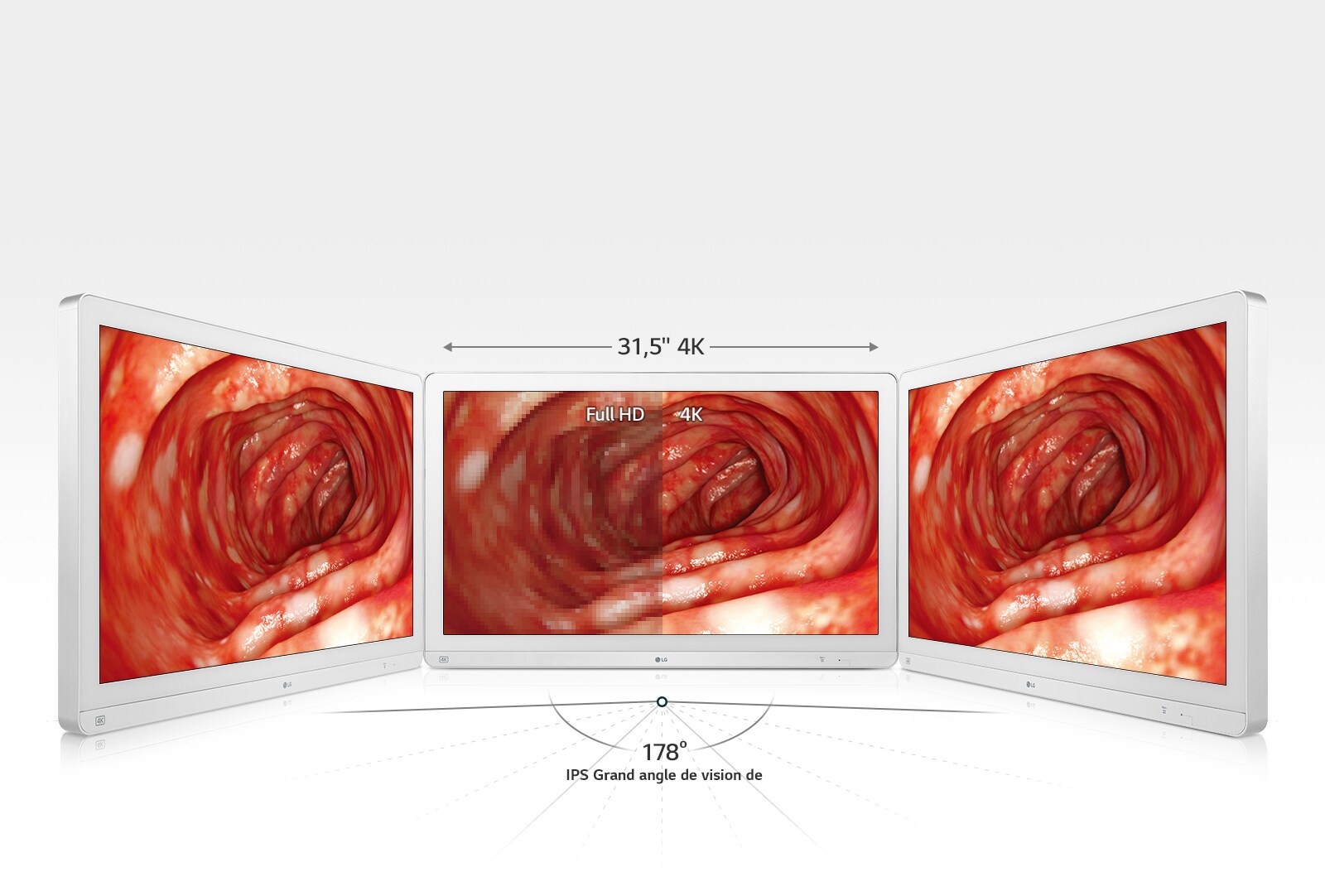 Plus de précision grâce à un grand angle de vue1