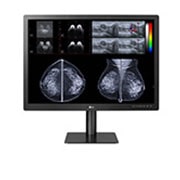 LG Moniteur de diagnostic pour la mammographie de 31 po et de 12 MP, vue de face avec les résultats d’imagerie de mammographie à l’écran, 31HN713D-BA, thumbnail 1