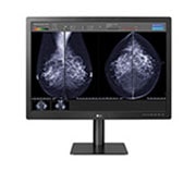 LG Moniteur de diagnostic pour la mammographie de 31 po et de 12 MP, vue de face avec les résultats d’imagerie de mammographie affichés dans un programme logiciel à l’écran, 31HN713D-BA, thumbnail 11