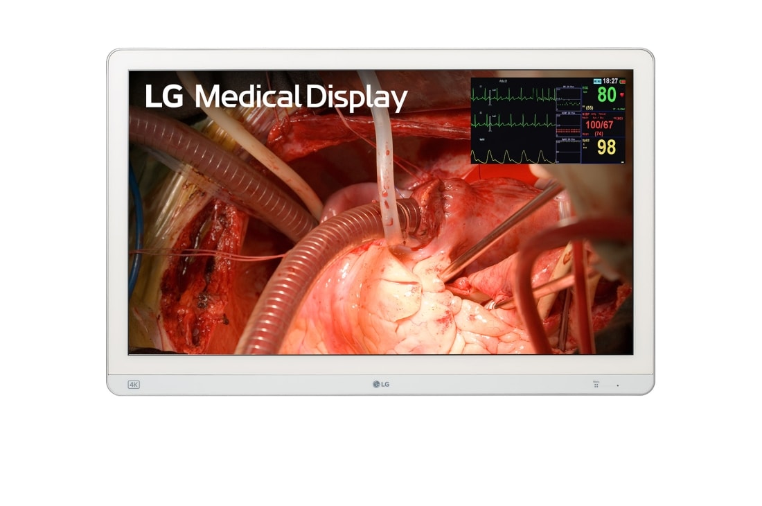 LG Moniteur chirurgical 27 po 4K avec mini-LED, Vue avant, 27HQ710S-W
