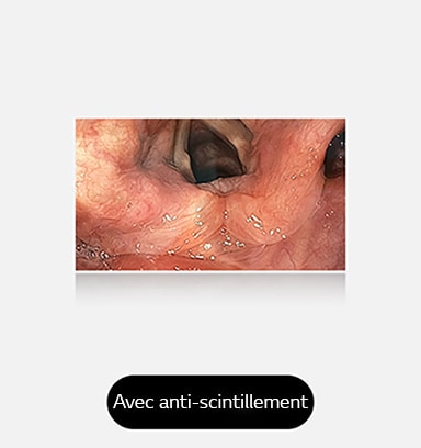 L’image de droite, avec revêtement anti-scintillement, offre un visuel net et non obstrué, qui démontre l’efficacité du revêtement.