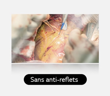 L’image de gauche montre un écran sans anti-reflets, avec plus de reflets et de scintillements qui affectent la visibilité.