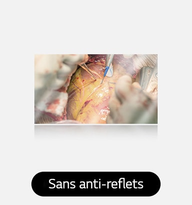 L’image de gauche montre un écran sans anti-reflets, avec plus de reflets et de scintillements qui affectent la visibilité.
