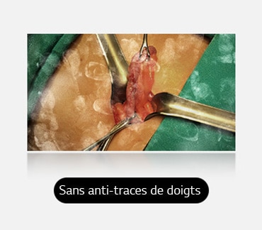 L’image de gauche montre un écran avec des traces de doigts visibles et des taches, obstruant la vue.