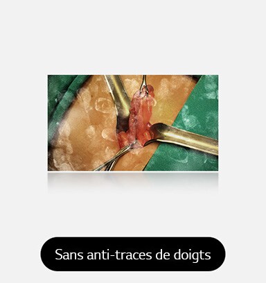 L’image de gauche montre un écran avec des traces de doigts visibles et des taches, obstruant la vue.